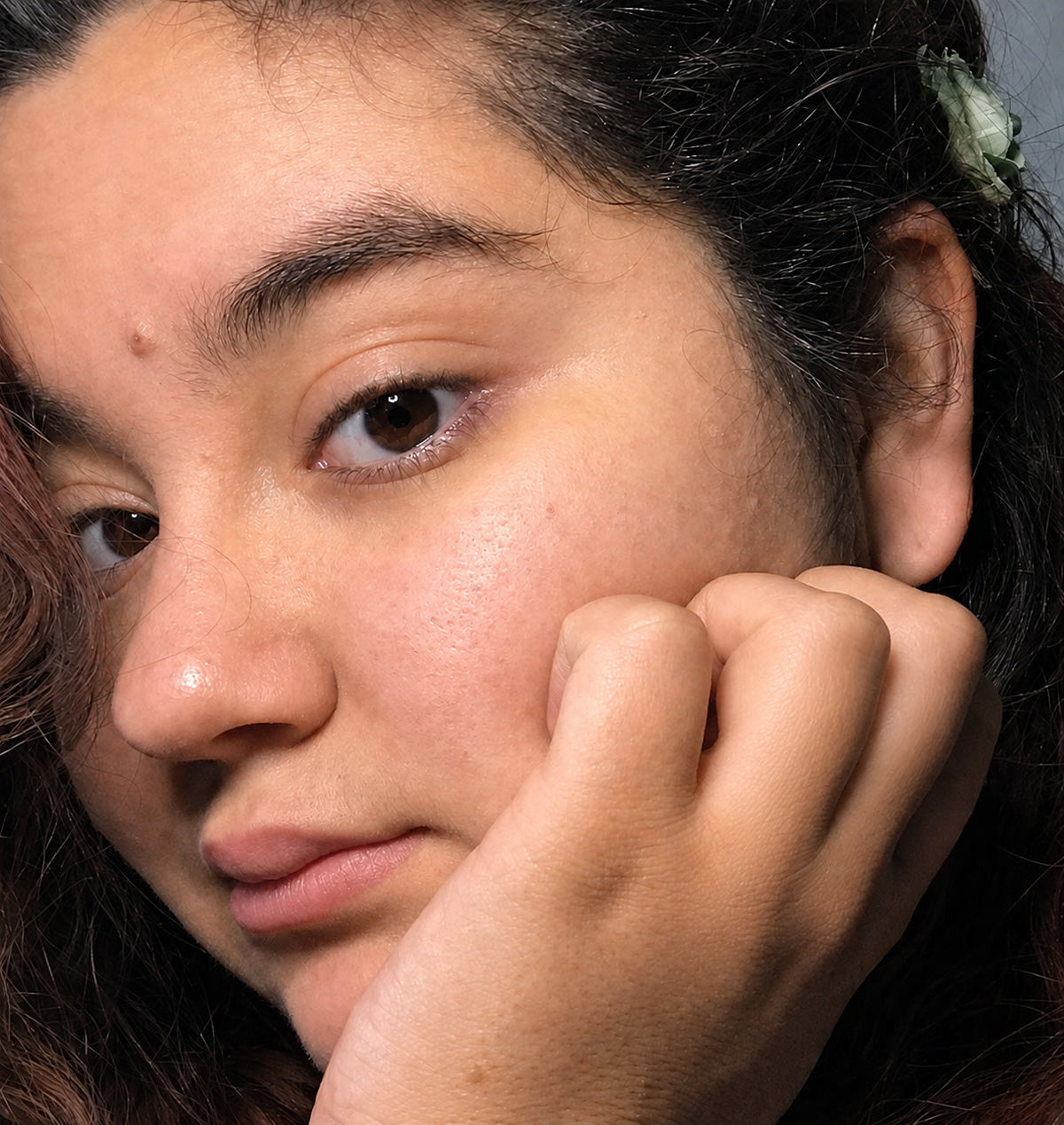 Portrait d'une femme avant le soin, peau au naturel